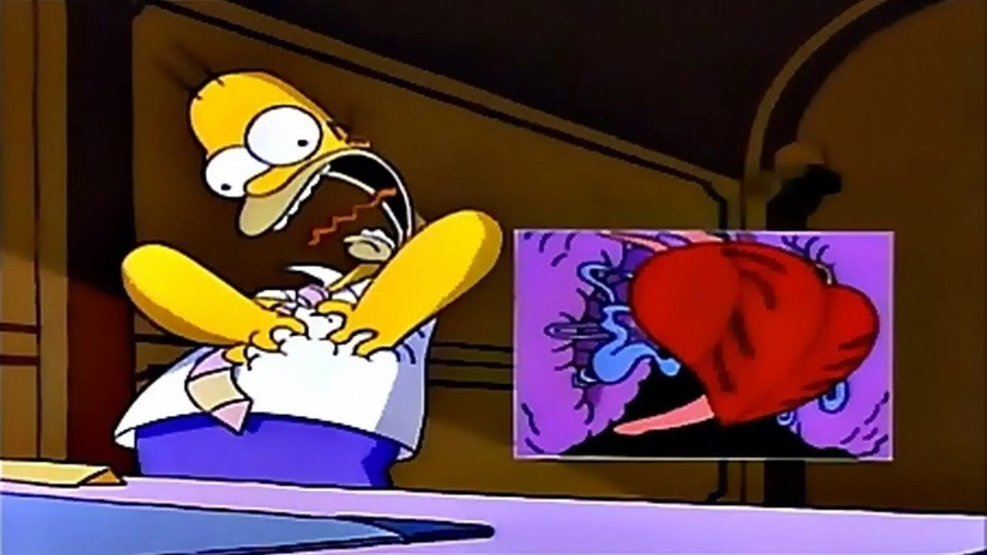 Los Simpson 04x11: El triple bypass de Homer - Corazón saturado